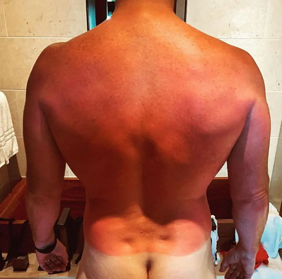 Chris Pratt naked sunburned ass