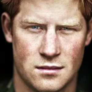 Prince Harry young freckles pic