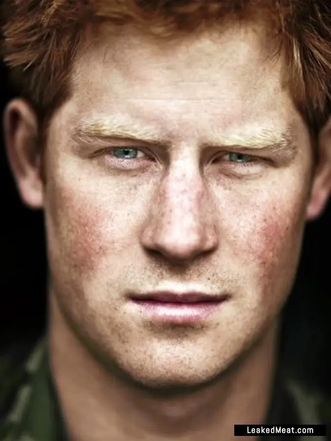 Prince Harry young freckles pic