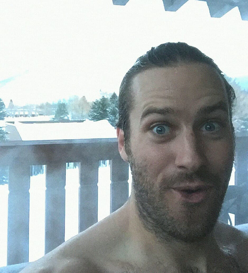 Armie hammer nude photos